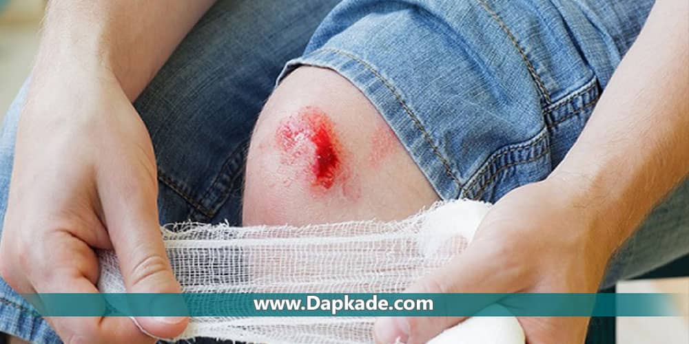 دیه دامیه چیست؟