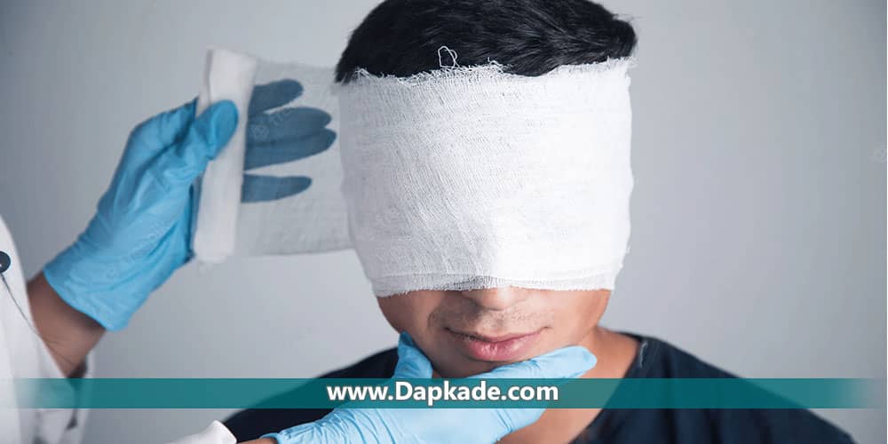 دیه منقله چیست